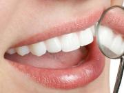 牙齿美容有哪些方法