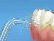 洗牙到底疼不疼