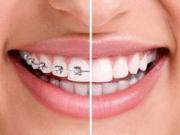 牙齿不齐是病，得治