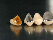 烤瓷牙与全瓷牙的区别和优缺点