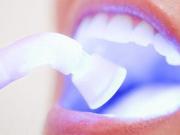 牙齿美白的误区