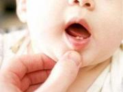 宝宝乳牙牙缝大正常吗